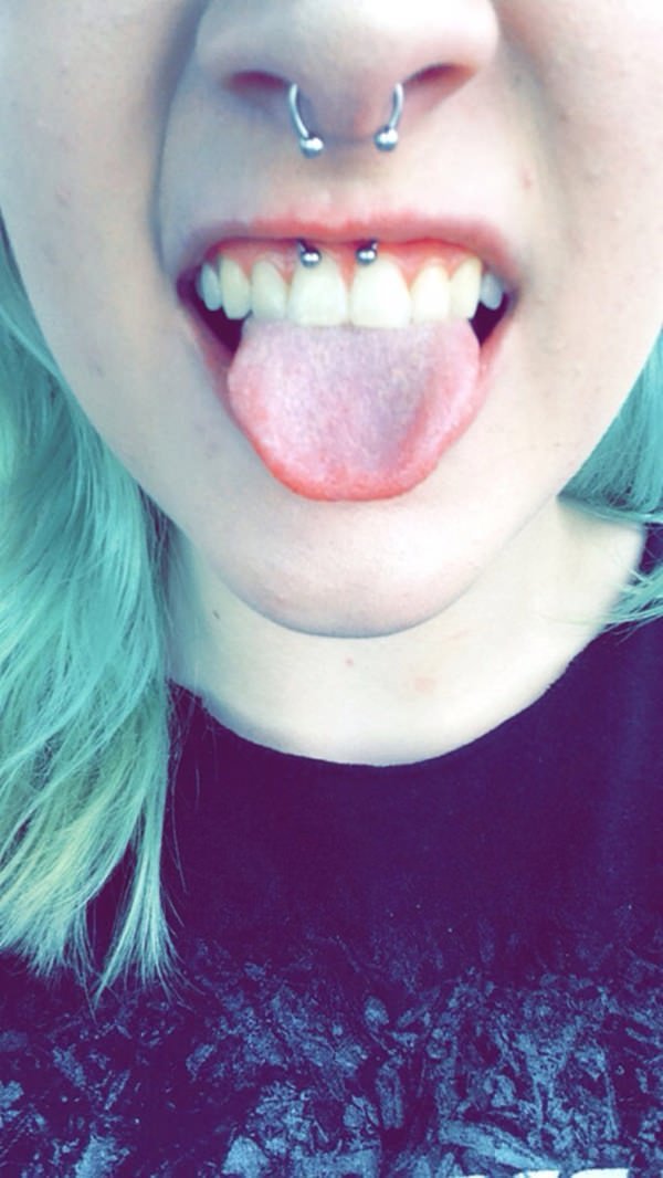 12smiley-piercing-081115