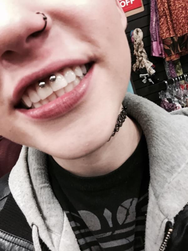 16smiley-piercing-081115