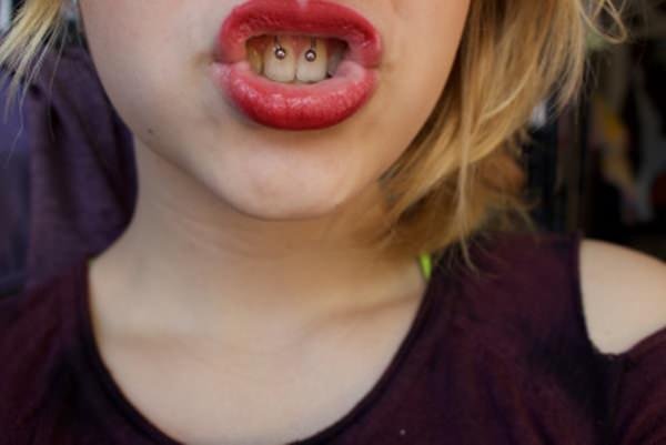 17smiley-piercing-081115