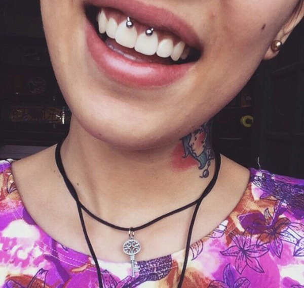 29smiley-piercing-110416