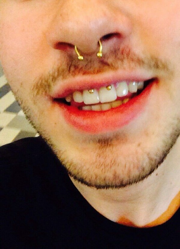 34smiley-piercing-110416