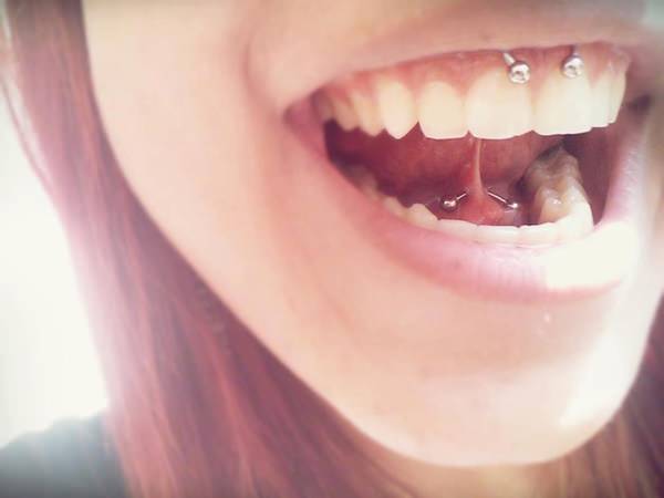 36smiley-piercing-081115