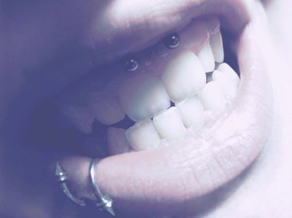 40smiley-piercing-081115