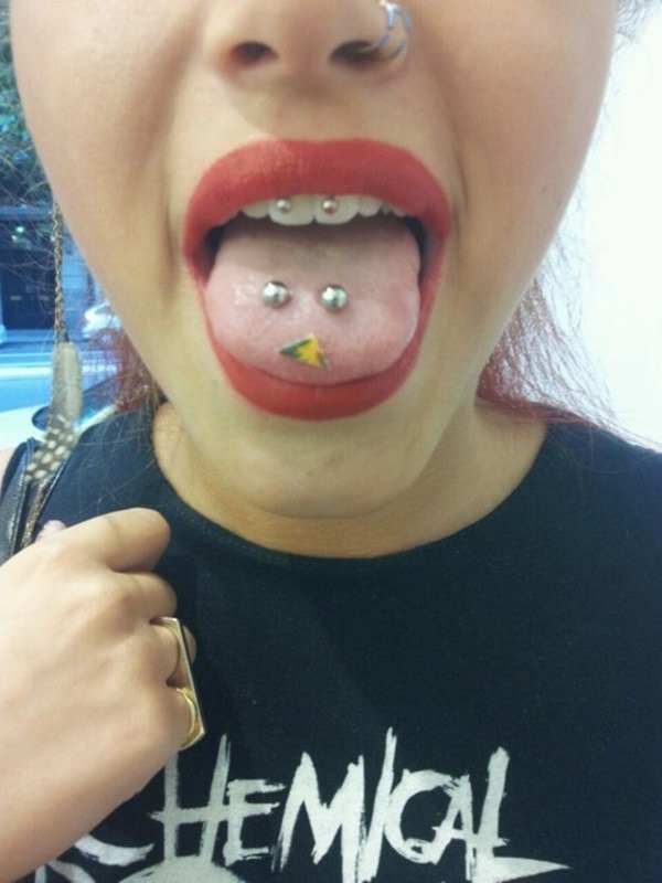 44smiley-piercing-081115